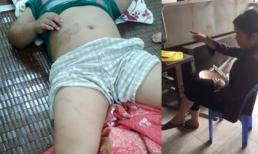 Mẹ kế hành hạ con chồng: 'Mày là con chó tao ăn thịt mày lâu rồi'