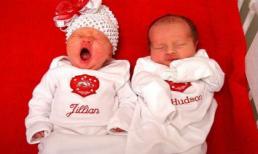 Cặp sinh đôi 'nhờ' hai ông bố khác nhau