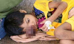 Bé 5 tuổi đối mặt với cái chết vì cha mẹ nhầm dấu hiệu ung thư