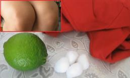 Mẹo làm trắng đầu gối và khuỷu tay chỉ với chanh