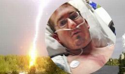 Sét đánh cháy xém người không chết