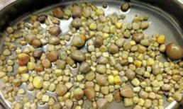 Phẫu thuật lấy ra 420 viên sỏi trong thận