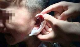 Cha mẹ sốc nặng khi con trai 4 tuổi bị cô giáo mầm non bấm ghim vào tai 