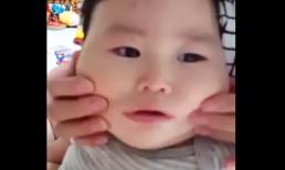 Chỉ là bẹo má thôi mà