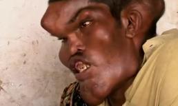 Người đàn ông có khuôn mặt quỷ dữ