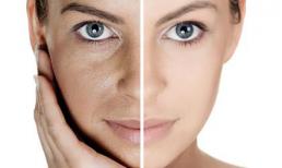 Tái sinh làn da, thon gọn gương mặt theo cách chuyên gia