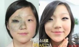 Kinh ngạc khả năng 'lột xác quạ hóa công' nhờ thẩm mỹ