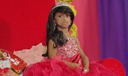 Thiếu nữ 18 trong hình hài cụ bà 144 tuổi