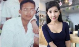 Quý bà công khai ảnh phẫu thuật chuyển giới gây sốt cộng đồng