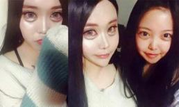 Kinh dị với cô gái mặt ếch vì chạy theo trào lưu mắt búp bê