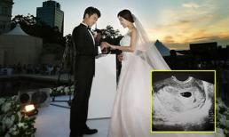 Tài tử 'Ước mơ vươn tới một ngôi sao' Ahn Jae Wook lên chức bố