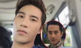 Nam ca sĩ Thái Lan bị vẹo mũi vì phẫu thuật thẩm mỹ