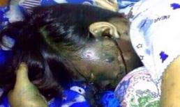 Cô gái bị chết cháy đen đáng sợ vì đeo tai nghe