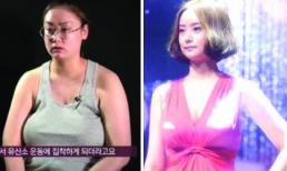 Từ ngực xệ thành 'nàng tiên' xinh đẹp nhờ phẫu thuật