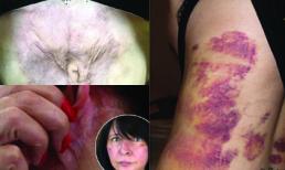 Nỗi đau tột cùng vì bị dị tật suốt đời sau phẫu thuật thẩm mỹ