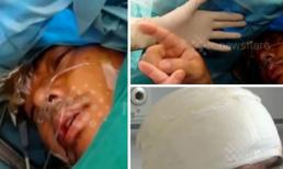 Người đàn ông khi phẫu thuật não vẫn nói chuyện được với bác sĩ