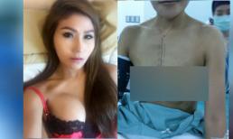 Quá trình 'nâng cấp vòng một' đau đớn của cô gái trẻ