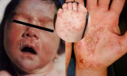 Bé 4 tuổi bị bệnh phụ khoa vì tắm ở bể bơi