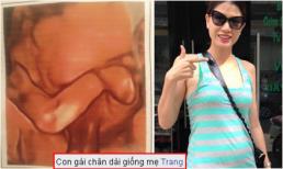 Trang Trần khoe ảnh siêu âm con 'chân dài giống mẹ'