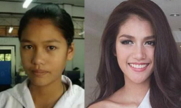 Tân Hoa hậu Hoàn vũ Thái Lan dính nghi án phẫu thuật thẩm mỹ