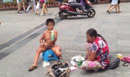 Cậu bé người đầy sẹo vì bỏng, đi ăn xin để chữa bệnh