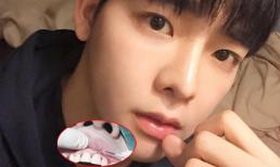 Hot boy Thái Lan tiết lộ ảnh làm lại cả hàm răng đau đớn