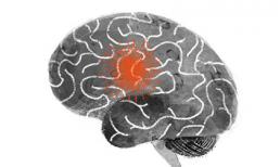 Dấu hiệu thường gặp của đột quỵ bạn không nên bỏ qua