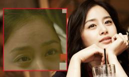 Kim Tae Hee bất ngờ bị tố phẫu thuật thẩm mỹ