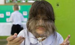 Những trường hợp dị dạng kỳ lạ của con người