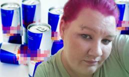 Người phụ nữ mất dần thị lực vì uống quá nhiều bò húc