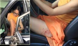 Lan Phương bị cướp giật túi xách kéo lê trên đường