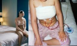 Hình ảnh đau đớn khi thực hiện phẫu thuật thẩm mỹ ở Hàn Quốc