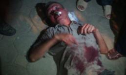 Cộng đồng bức xúc khi nam thanh niên đánh cụ già 70 tuổi chảy máu