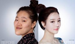 Cô gái mặt dị dạng hóa hot girl nhờ thẩm mỹ 