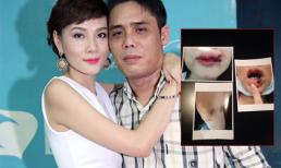 Chồng cũ Dương Yến Ngọc tố vợ lấy ảnh bị ngã, bơm môi để vu vạ