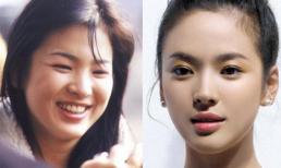 Bất ngờ với hiệu quả tạo hình khuôn mặt V-line và mũi S-line chuẩn mực