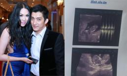 Chồng Phi Thanh Vân khoe ảnh siêu âm con 