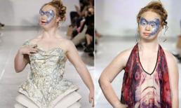 Người mẫu mắc bệnh Down tự tin trên sàn diễn thời trang quốc tế