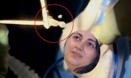 Phát hiện sán dây trong não sau khi thấy đau đầu kéo dài