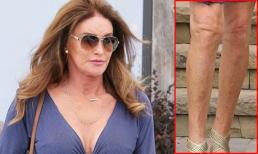 Bố dượng Kim lộ chân gầy guộc, sứt sẹo khi diện váy