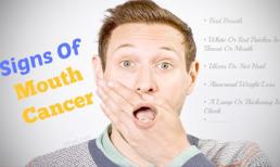 Dấu hiệu sớm nhất của bệnh ung thư miệng