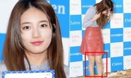 Suzy luống cuống vì đôi chân lốm đốm phấn