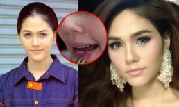 Mỹ nhân Thái Lan Chompoo Araya dính nghi án phẫu thuật thẩm mỹ mũi