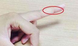 Những bệnh tiềm ẩn có thể phát hiện được khi nhìn ngón tay