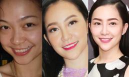 Cằm Linh Nga lại một lần 'biến đổi' khi ngày càng dài và nhọn