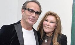 'Thảm họa dao kéo Mỹ' bất ngờ tái xuất bên bồ trẻ