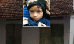 Giải cứu bé gái bị nhốt trên người chằng chịt vết thương