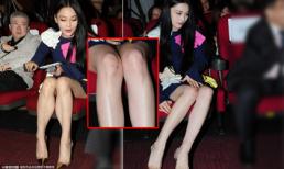 Mỹ nhân Trương Hinh Dư mặc váy ngắn lộ vết thâm tím khó hiểu ở đầu gối 