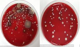 Cận cảnh vi khuẩn sống ở nơi công sở gây hại cho con người