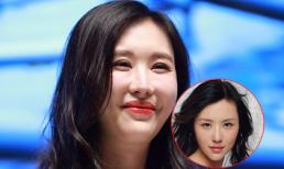 Sao 'Chân Hoàn truyện' lộ mặt sưng phù vì thẩm mỹ